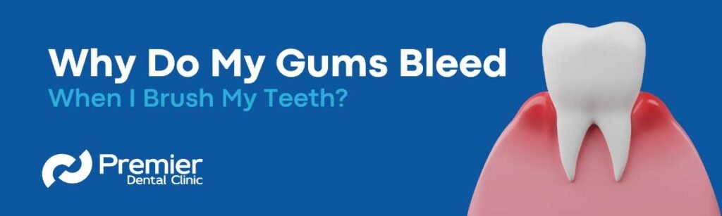 Why do my gums bleed when I brush my teeth? 
